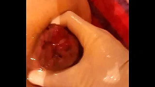 55 fisting porn videos